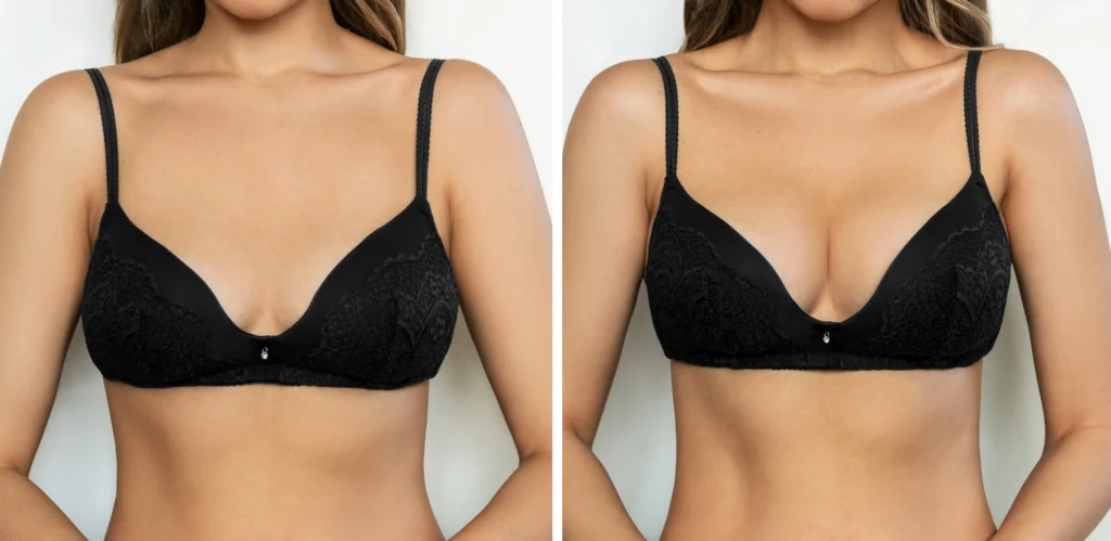 Dr. John Shamoun – Newport Beach Plastic and Cosmetic Surgeon California Results Breast
